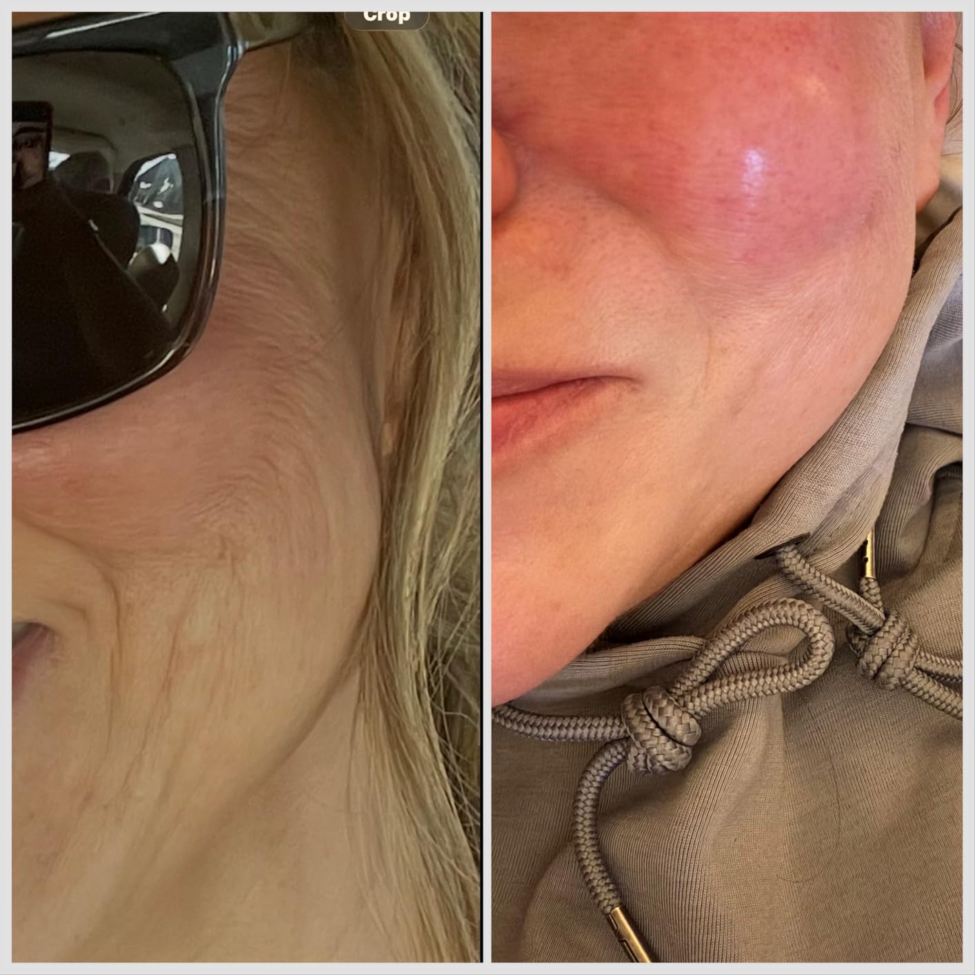 RoC Retinol Correxion Deep Wrinkle Retinol Face Serum with Ascorbic Acid, Anti-Aging Treatment for Fine Lines, Dark Spots, Post-Acne Scars, 1 Oz customer photo 2