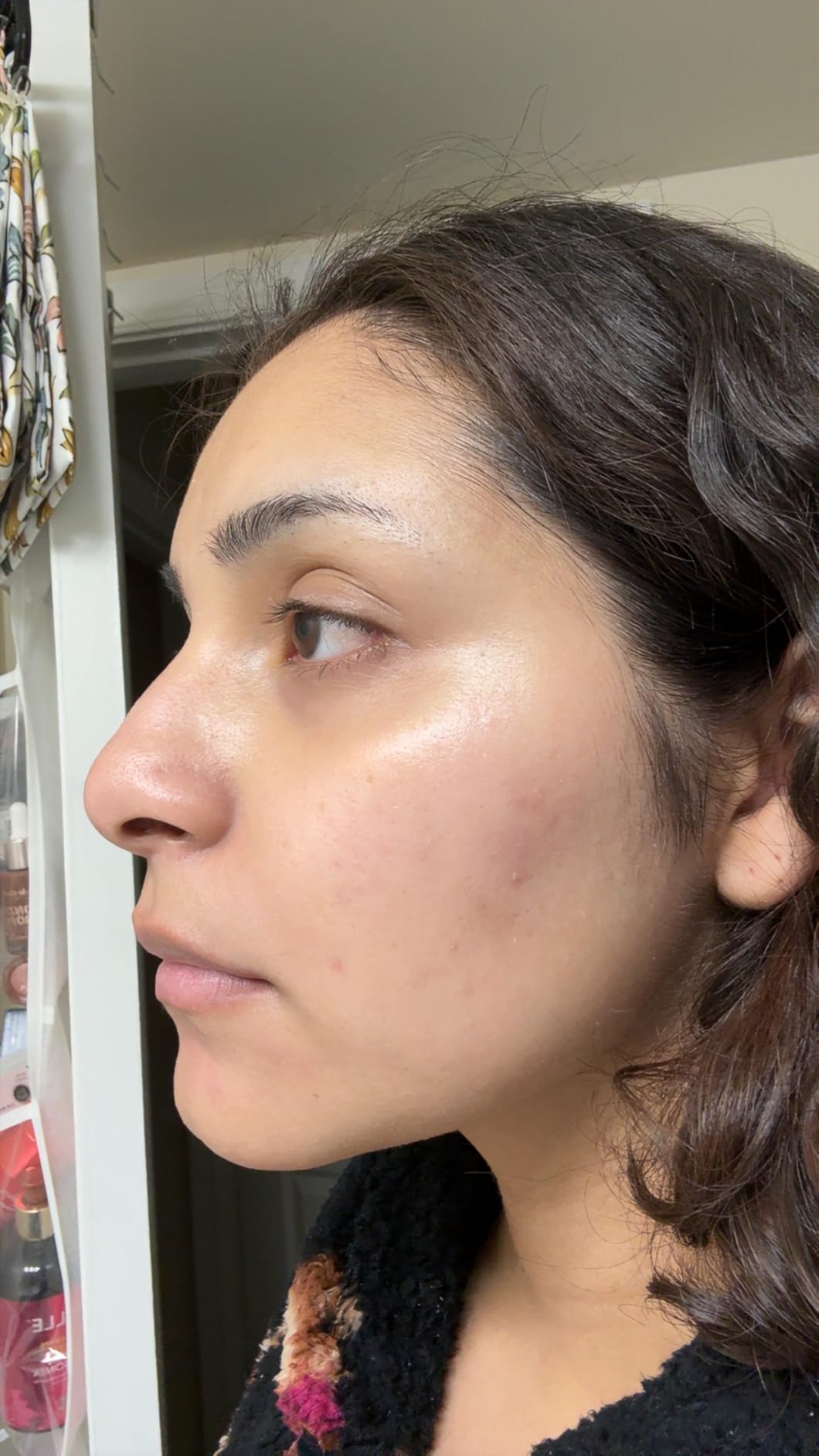 La Roche-Posay Cicaplast Balm B5, Healing Ointment and Soothing Therapeutic Multi Purpose Cream for Dry & Irritated Skin, Body and Hand Balm, Baby Safe, Fragrance Free customer photo 1