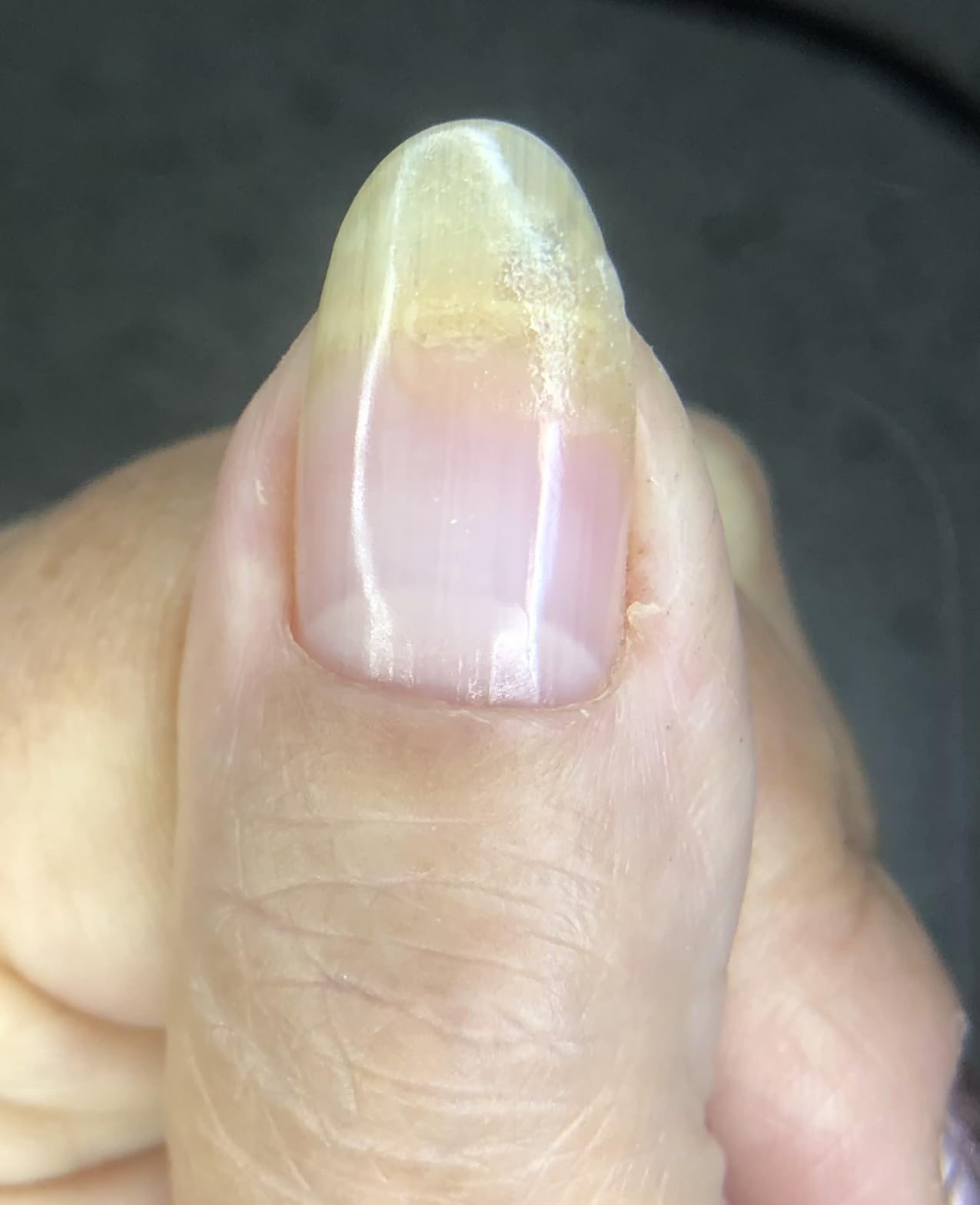 Orly Nail Rescue Boxed Kit customer photo 2