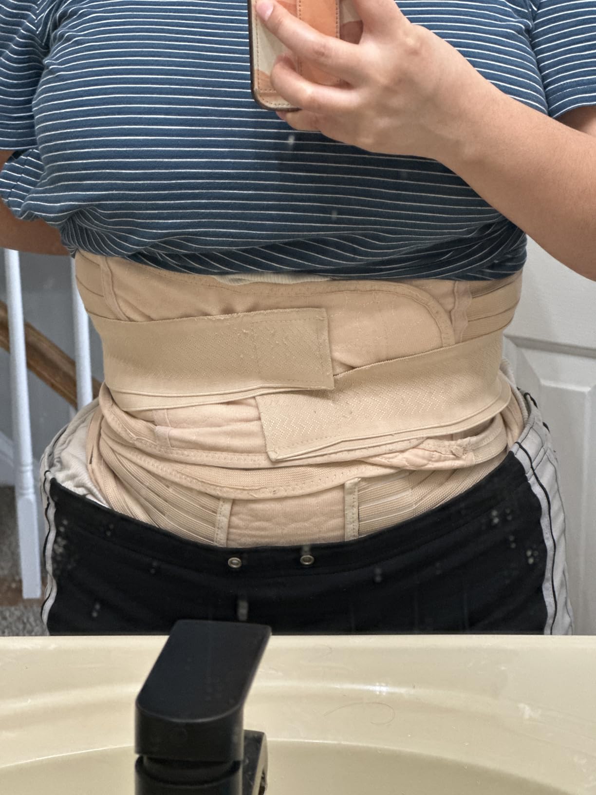 ChongErfei 3 in 1 Postpartum Support - Recovery Belly/waist/pelvis Belt Shapewear Slimming Girdle, Beige, L customer photo 1
