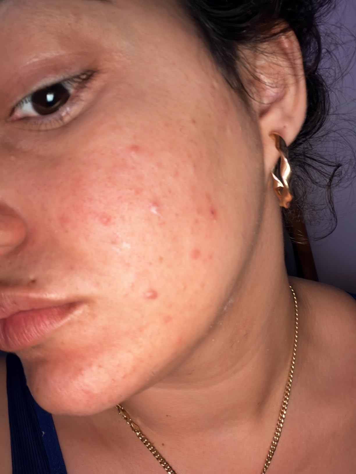 La Roche-Posay Toleriane Double Repair Face Moisturizer, Daily Moisturizer Face Cream with Ceramide & Niacinamide for All Skin Types, Immediate Comfort & Long Lasting Hydration, Fragrance Free customer photo 1