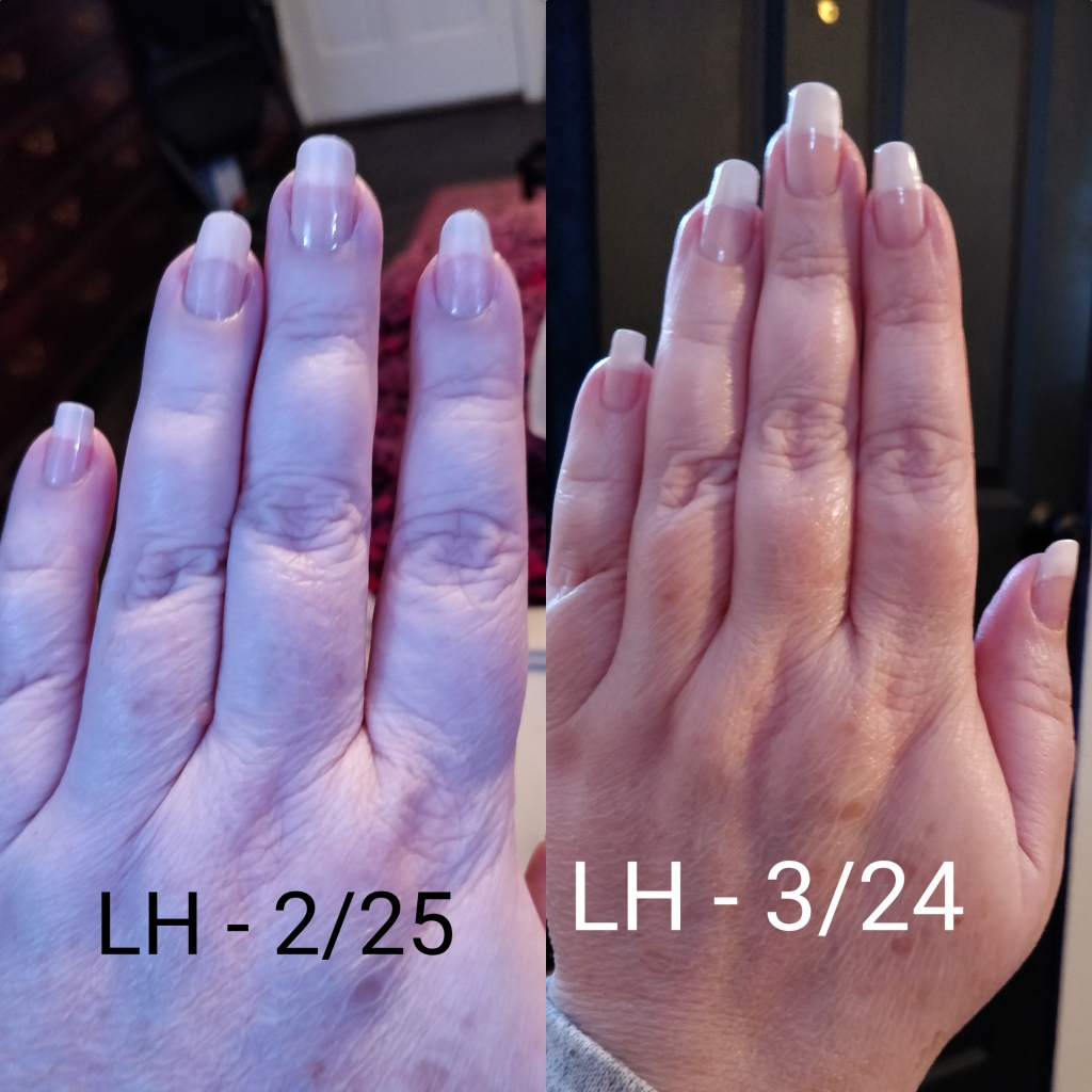 Nail-Aid Keratin 3 Day Growth Nail Treatment & Strengthener, Clear, 0.55 Fl Oz customer photo 2