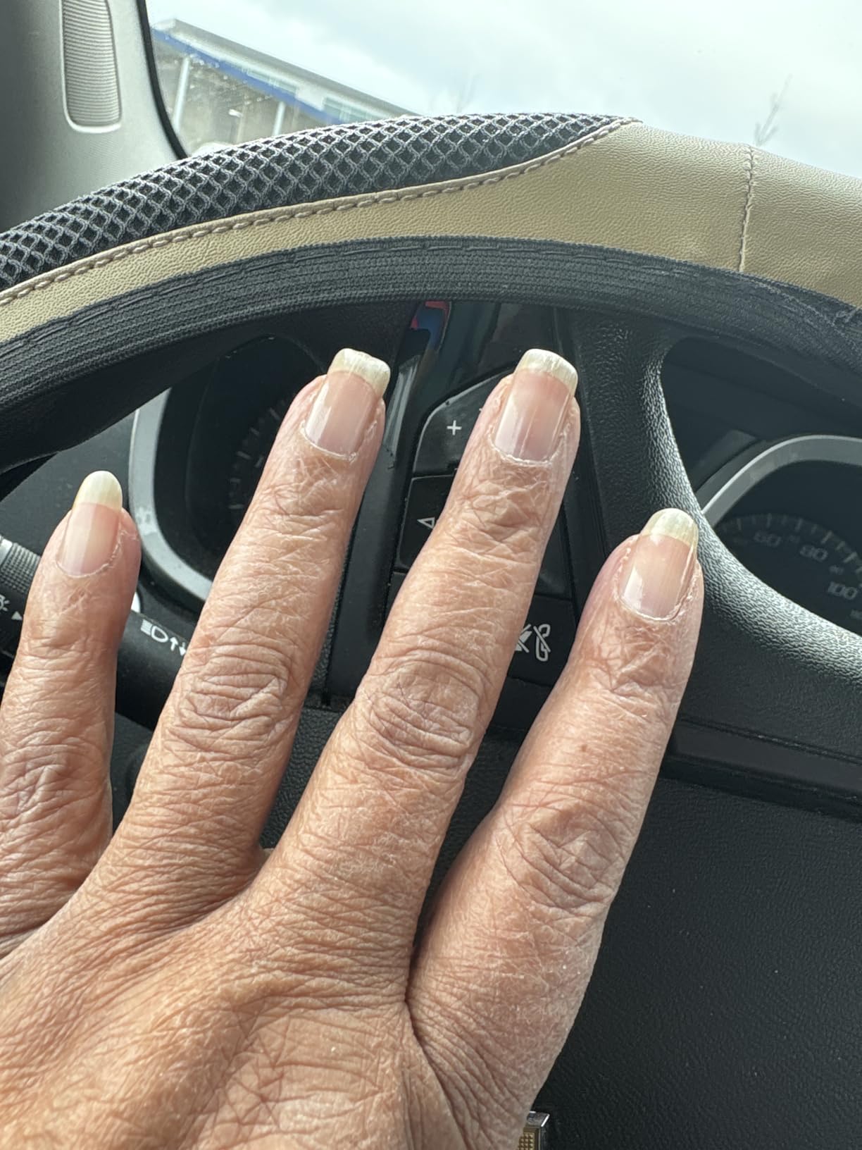 Probelle Nail Strengthener and growth, Natural Nail Strengthening Clear Nail Polish Repair Treatment, Nail Growth & Conditioning, Stops Splits, Chips, Cracks & Strengthens Damaged and Thin Nails customer photo 1
