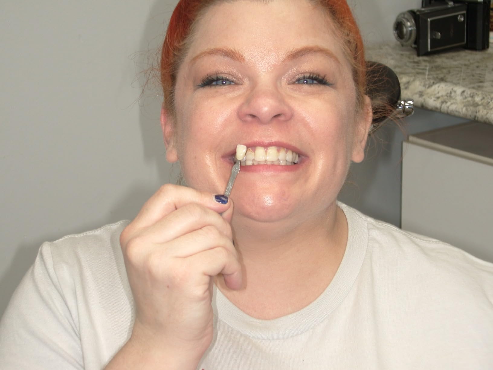 SNOW Diamond Wired Whitening Kit - Sensitive Teeth Whitening Kit - Whitens & Repairs Teeth - 6 Months of Whitening Treatment - Gentle & Enamel Safe - Blue customer photo 1