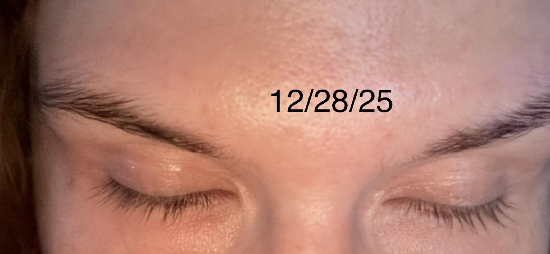 Grande Cosmetics GrandeLASH-MD Lash Enhancing Serum - Peptide & Vitamin Infused Formula for Longer, Thicker, Fuller Looking Lashes - Ophthalmologist Tested, Cruelty-Free customer photo 2