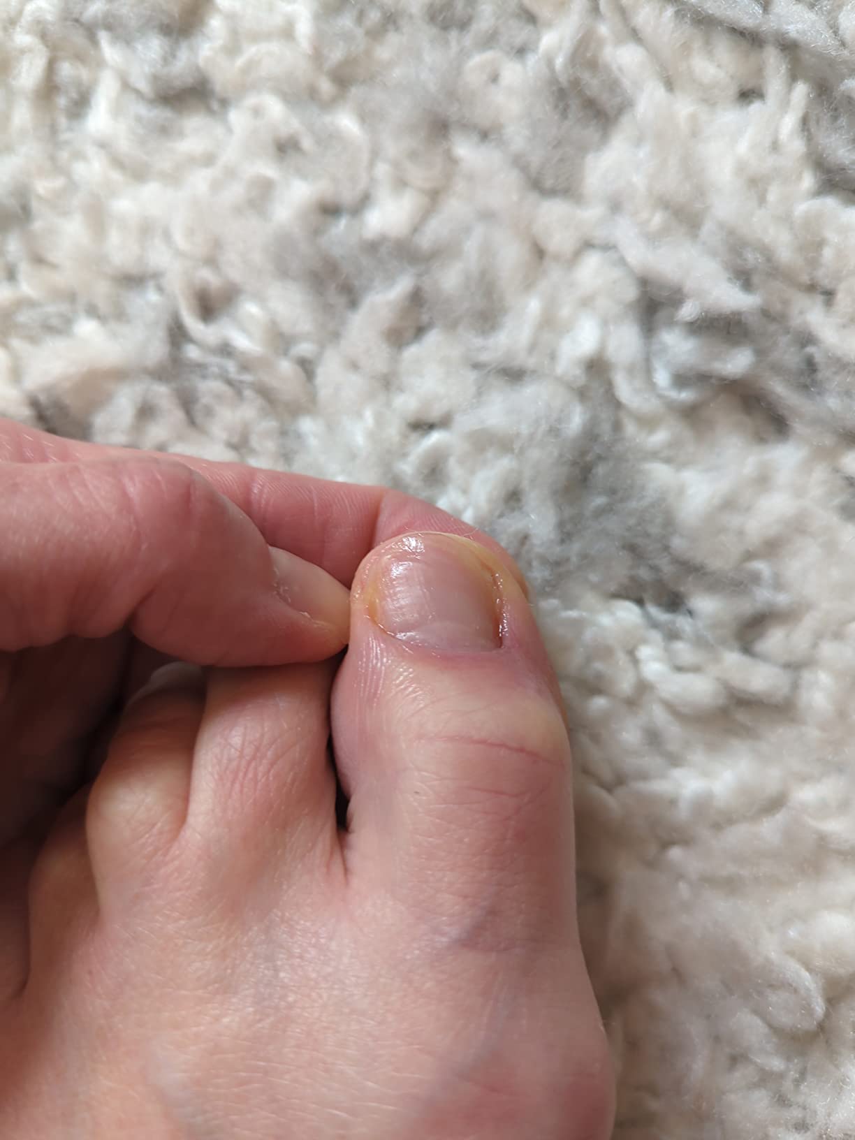 Kerasal Multi-Purpose Nail Repair, Nail Solution for Discolored and Damaged Nails, 0.43 fl oz customer photo 1