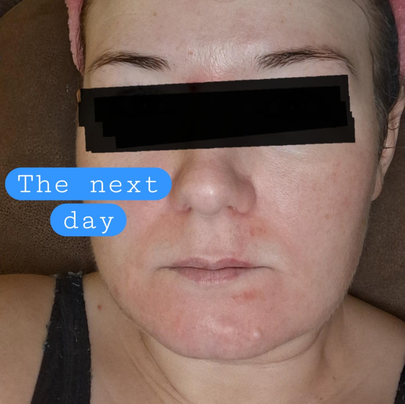 CeraVe Moisturizing Cream, Face Body Moisturizer, Normal to Dry Skin, 8 Fl Oz customer photo 1