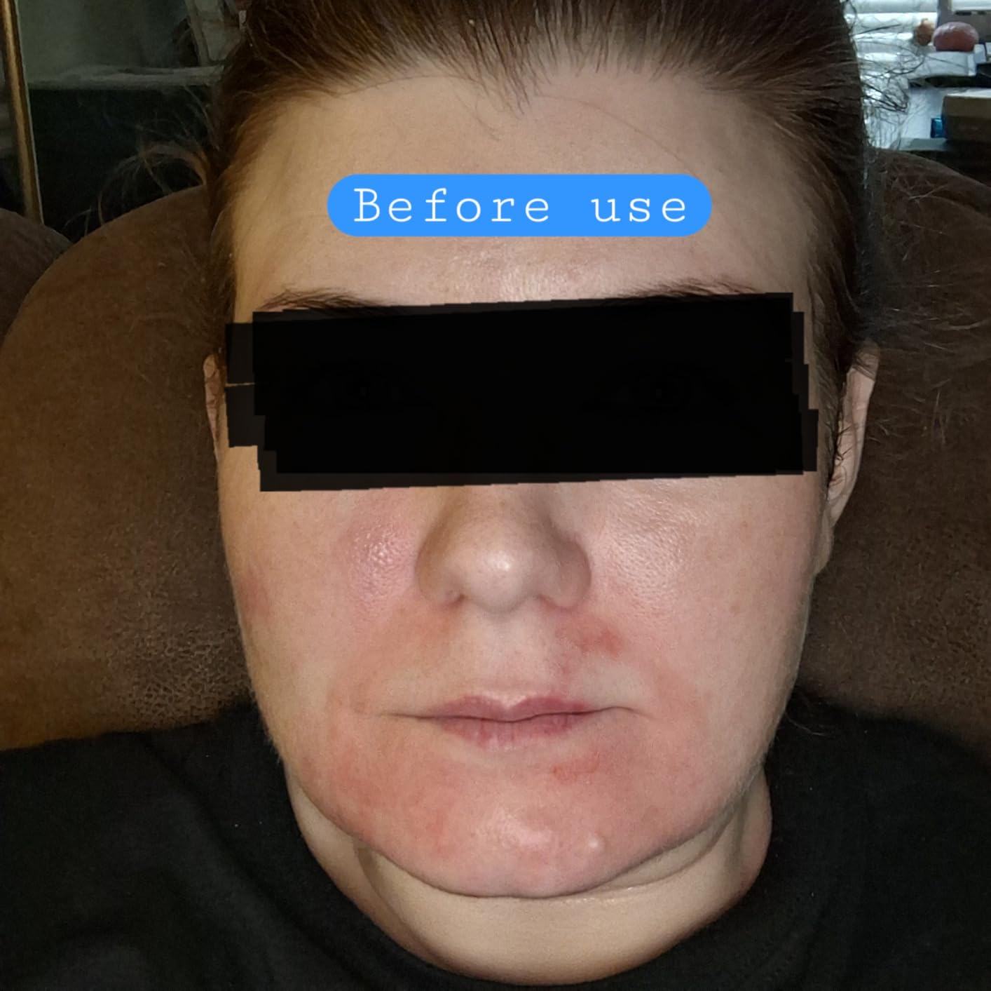 CeraVe Moisturizing Cream, Face Body Moisturizer, Normal to Dry Skin, 8 Fl Oz customer photo 2