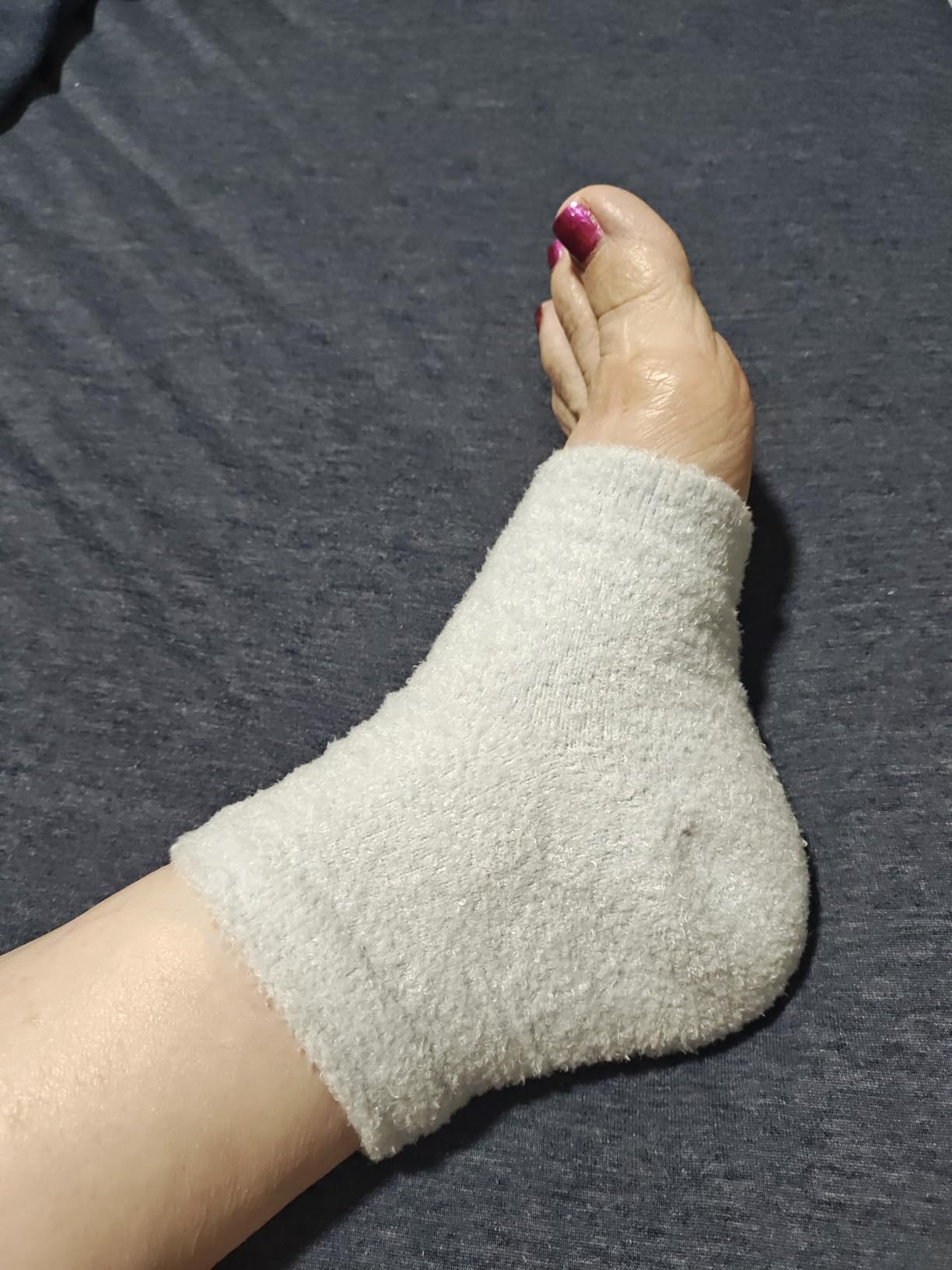 ZenToes Moisturizing Fuzzy Sleep Socks with Vitamin E, Olive Oil and Jojoba Seed Oil to Soften and Hydrate Dry Cracked Heels customer photo 1
