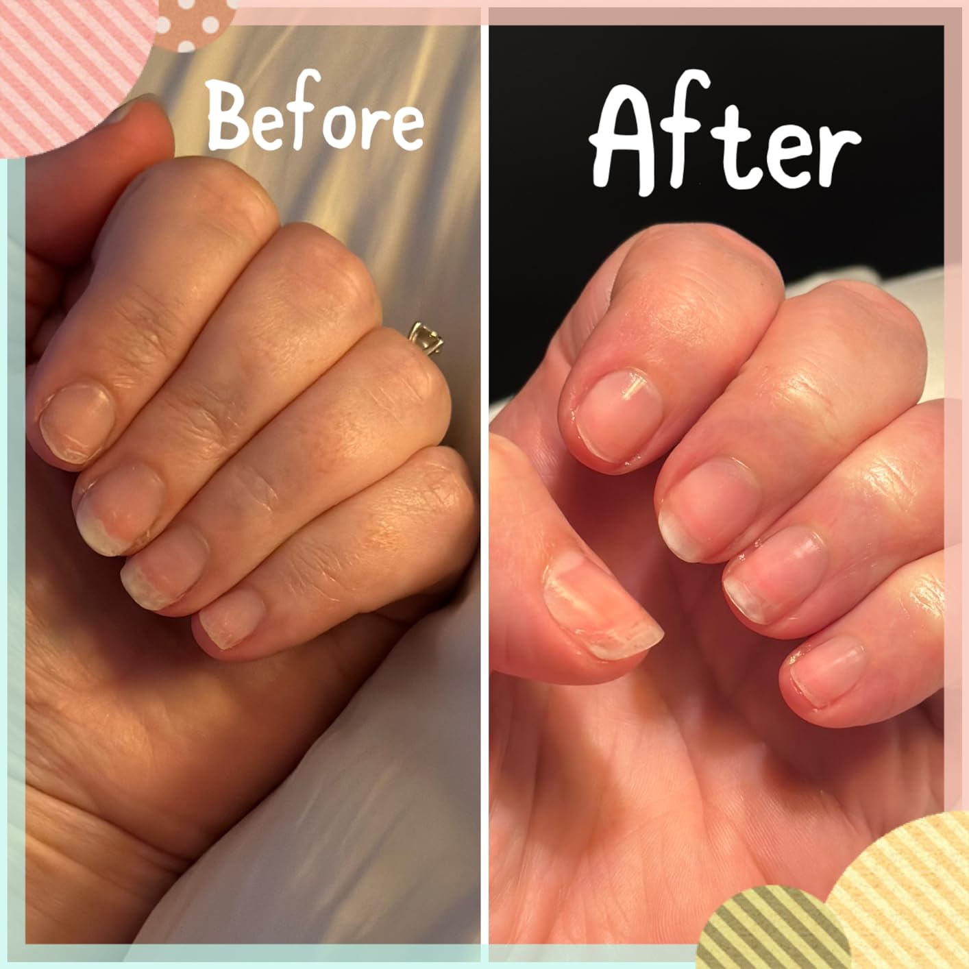 Dr. Dana Nail Repair Kit for Damaged Nails - Strengthening & Exfoliating Treatment with Glycolic Acid, Nail Primer, Hydrator & Priming Wand for Shiny, Healthy Nails, Nail Care Kit customer photo 1