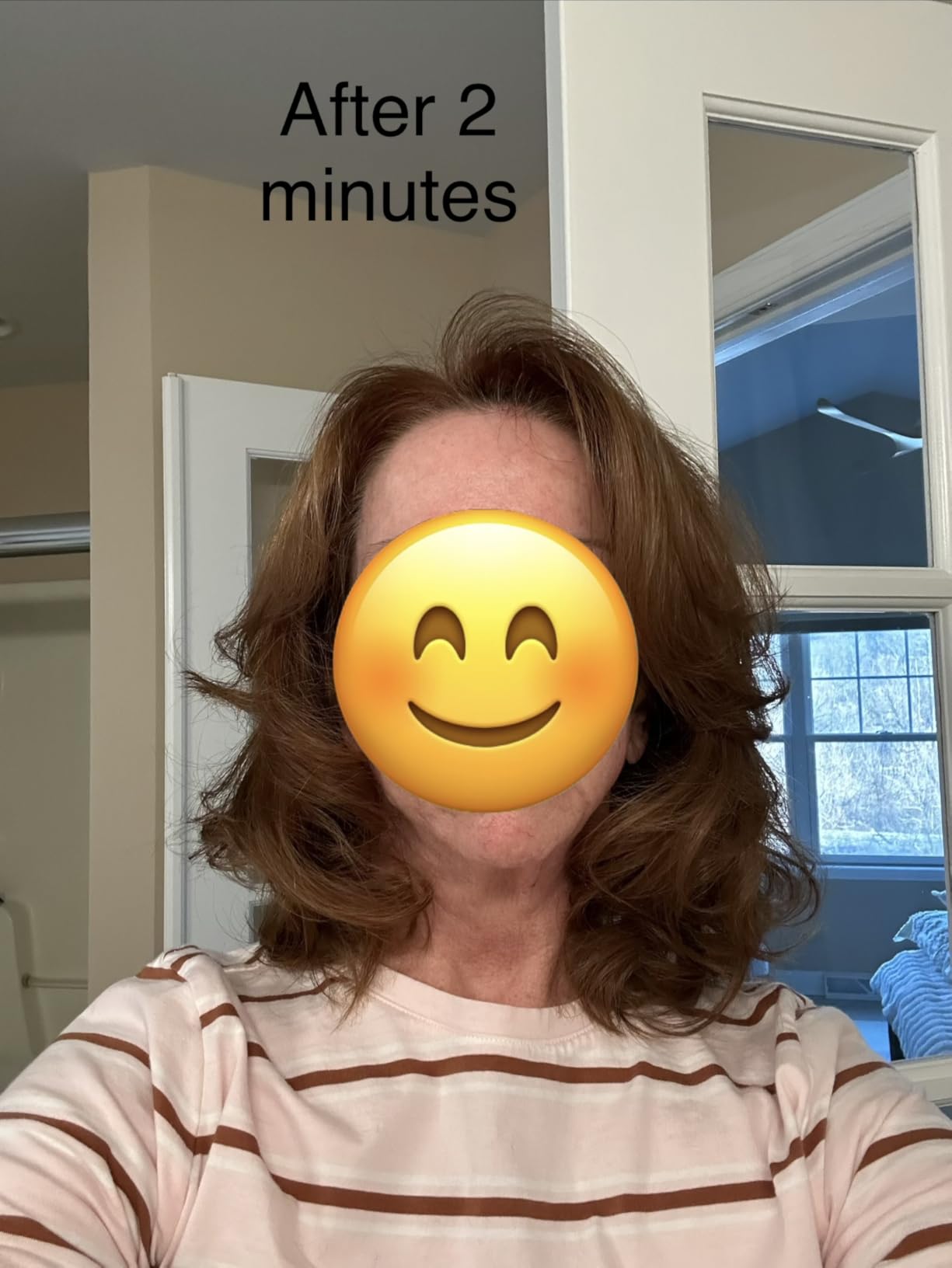Conair Hot Rollers for Long, Medium & Short Hair, 12 Jumbo 1.5