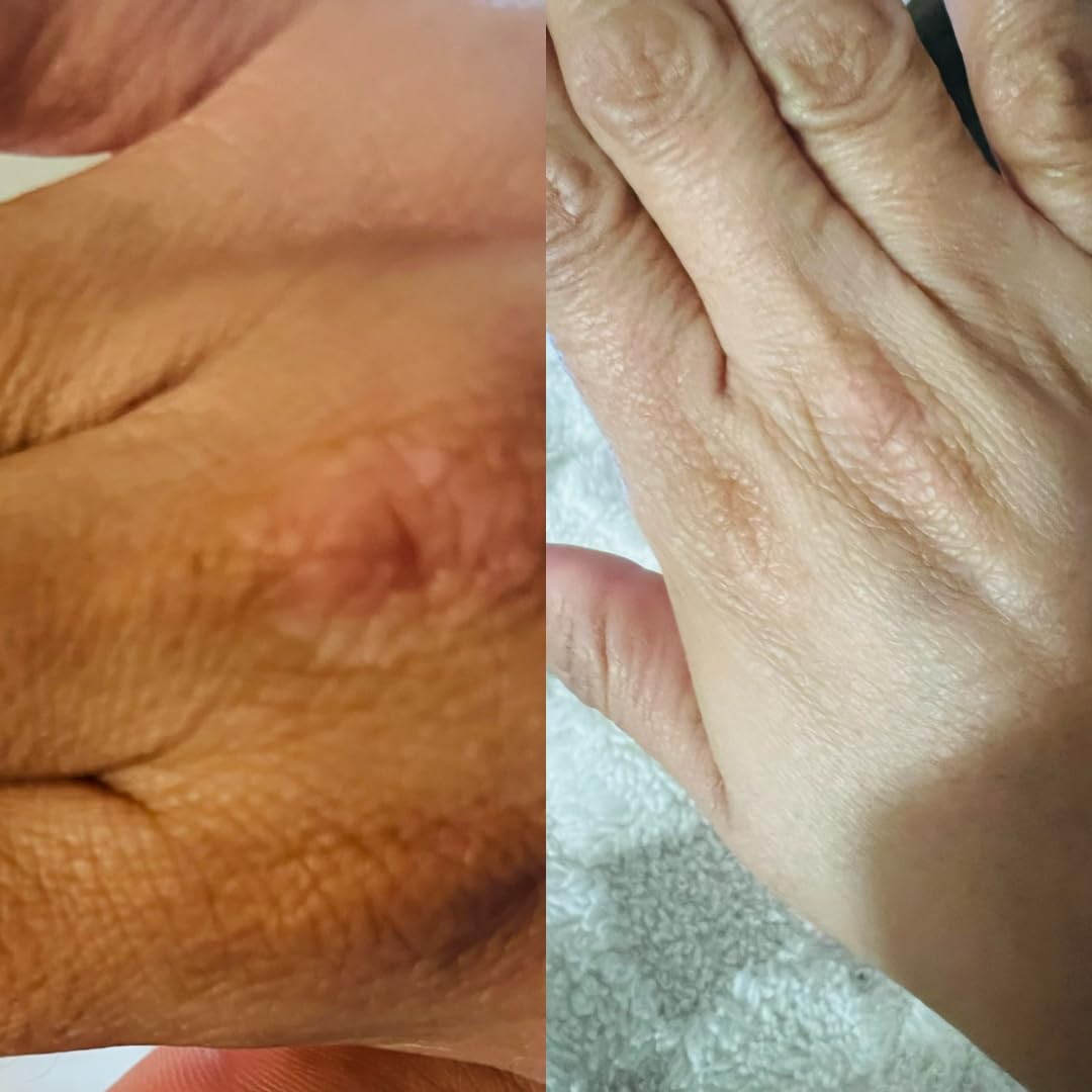 EQQUALBERRY Vitamin Illuminating Serum | Niacinamide 4% + Brightening Vitamin C Face Serum with Hyaluronic Acid & Vitamin E | Dark Spot, Uneven Tone Care | Korean Skincare, 1.01 fl.oz customer photo 1
