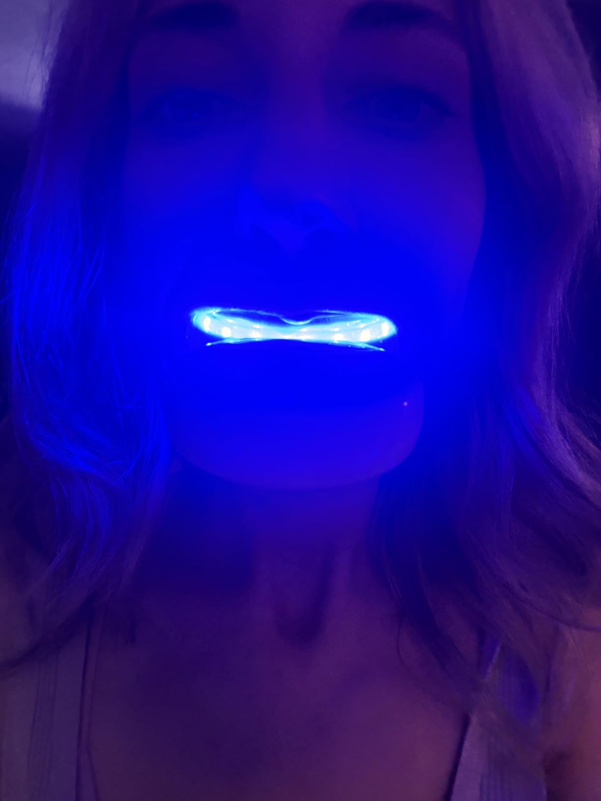 Whitebite Pro Teeth Whitening Kit for Sensitive Teeth - 32X LED Light + 35% Carbamide Peroxide Gel + Remineralizing Gel | Dental-Grade Whitening at Home Flavor Mint customer photo 1