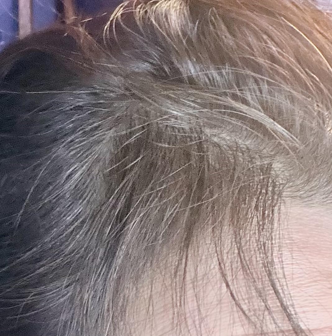Laser Hair Growth Cap, Red Light theray for Hair, Deep Black Cap customer photo 1