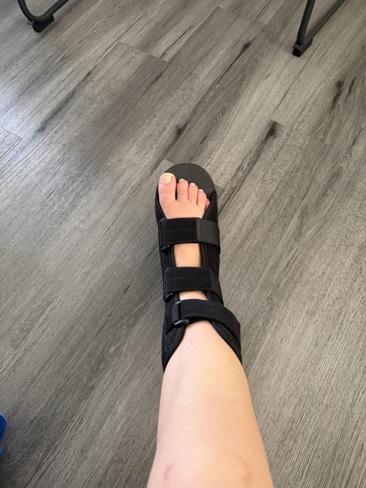 Estinko AFO Foot Drop Brace, Foot Drop Brace for Walking Drop Foot Brace Adjustable ALS, TBI, MS, Diabetes Stroke (Black, Medium) customer photo 2