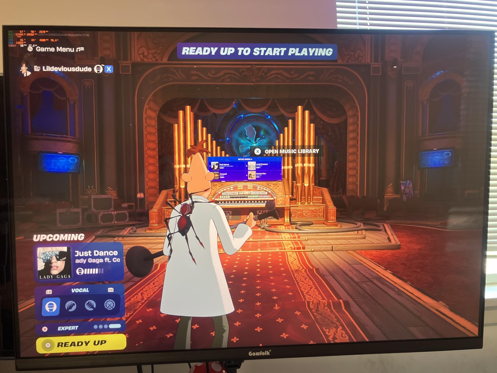 27 Inch 4K Gaming Monitor, UHD 160Hz/ FHD 320Hz Dual Mode PC Monitor, IPS Computer Screen, Built-in Speakers, PIP/PBP, FreeSync, HDMI 2.1 & DP 1.4, Wall Mount Compatible 75 * 75mm customer photo 1
