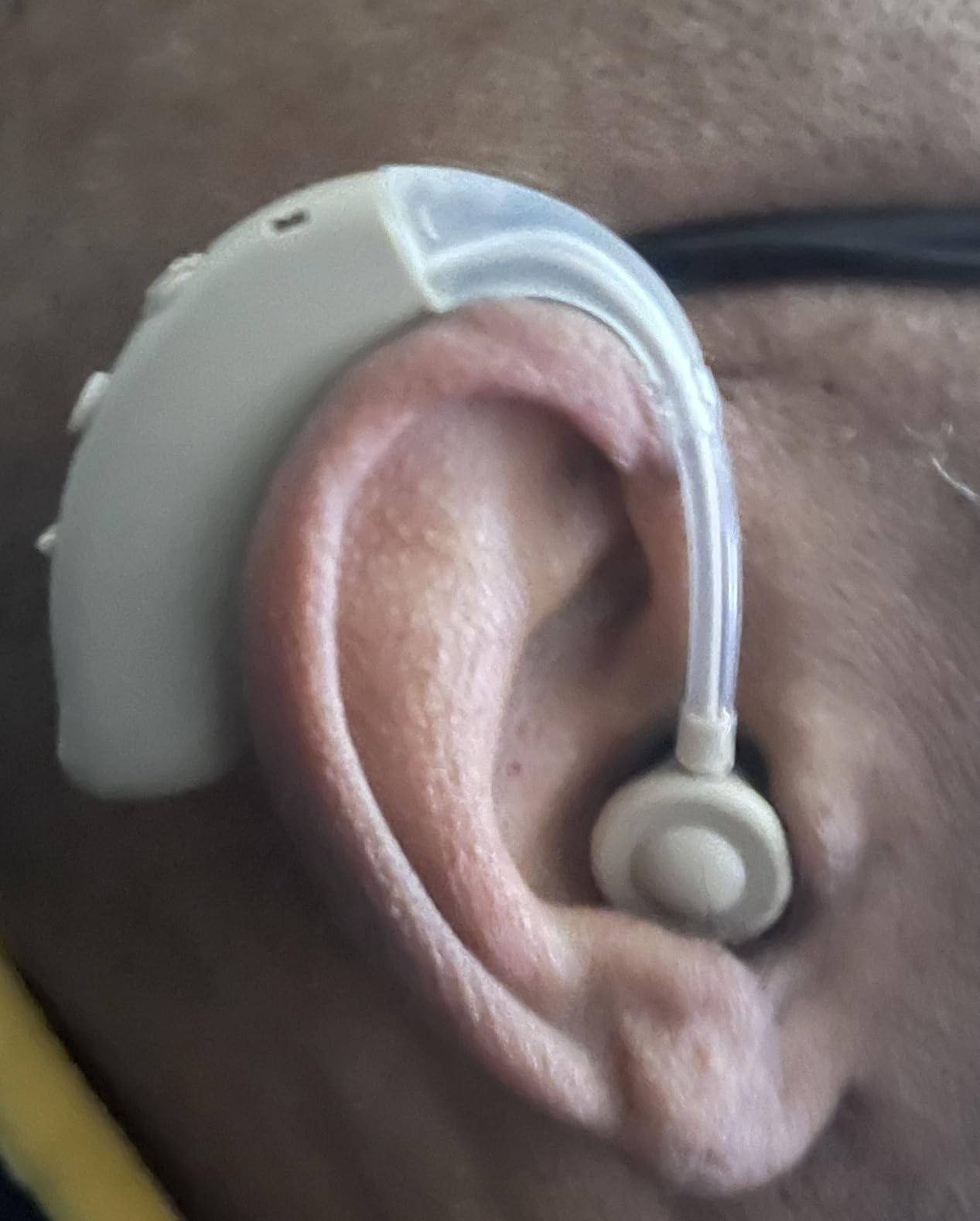 OTC Hearing Aids Rechargeable for Seniors, Lightweight Hearing Amplifiers for Adults with Intelligent Noise Reduction, Portable Behind-the-Ear Hearing Aid Headphones Comfortable Wearing customer photo 1