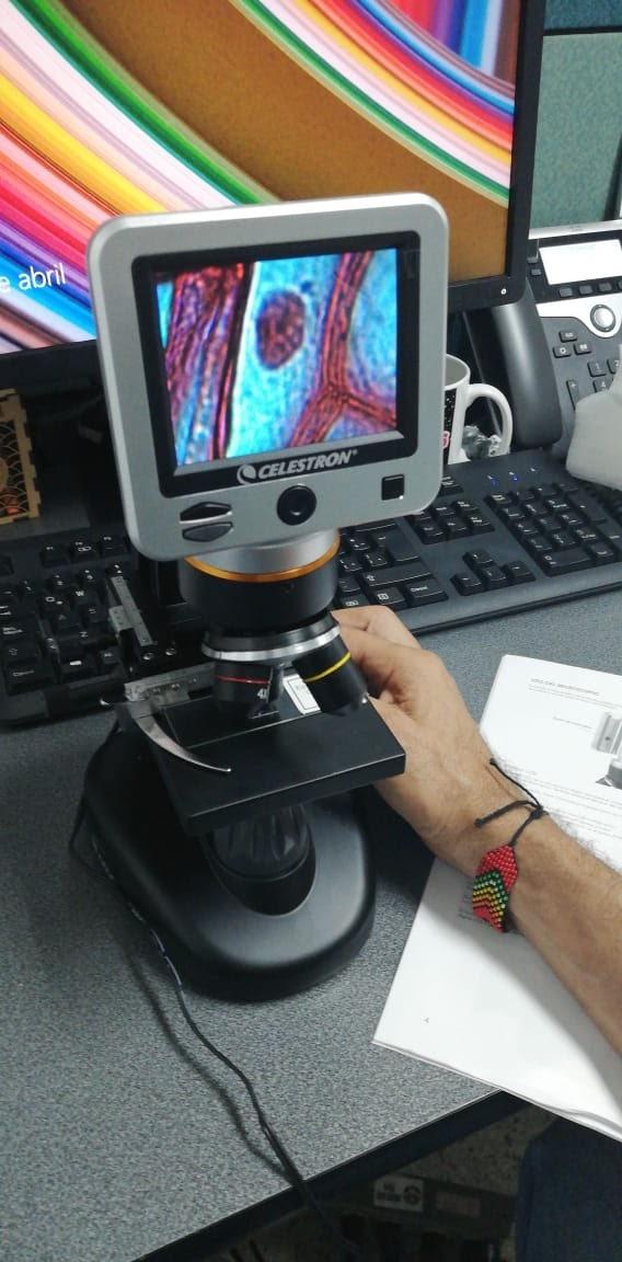 Celestron TetraView LCD Digital Microscope - Biological Microscope with Built-in 5MP Digital Camera customer photo 1