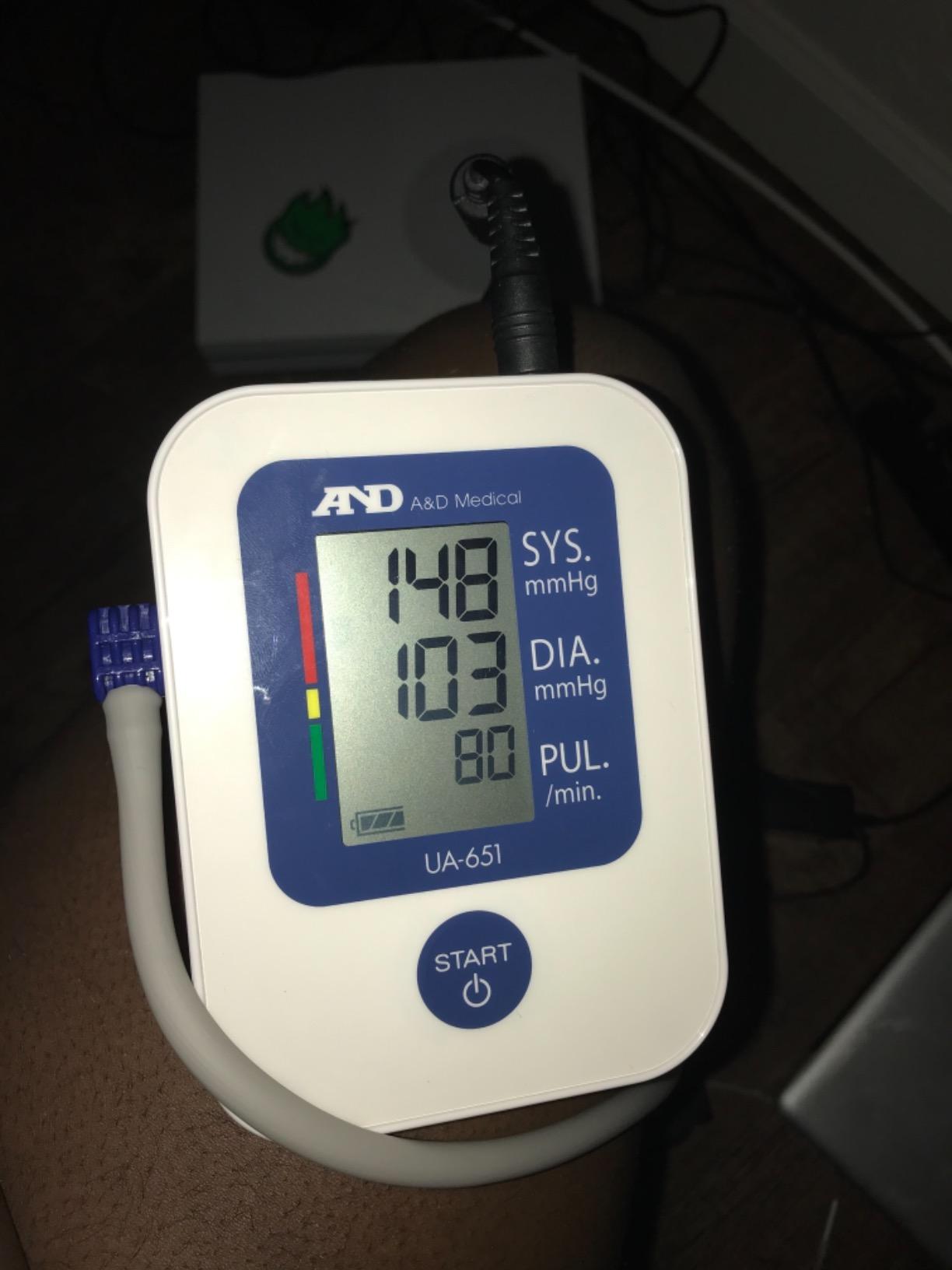 A&D Medical Blood Pressure Monitor for Home Use, UA-651 - Upper Arm Precise BP Machine - Wide Range Cuff (8.6-16.5