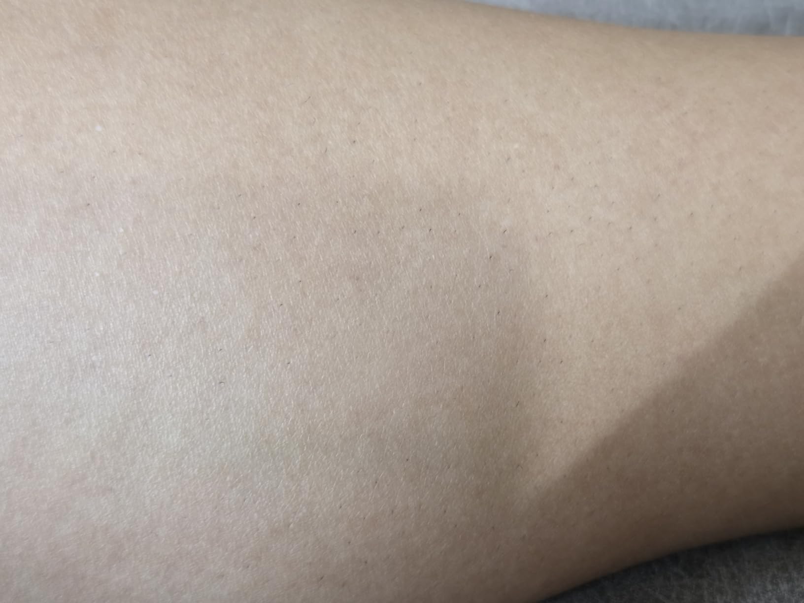Braun IPL, Silk Expert Pro 5, IPL Hair Removal for Women and Men, Permanent Laser Hair Reduction At-Home, 2 Heads, Pouch, IPL5137 customer photo 2