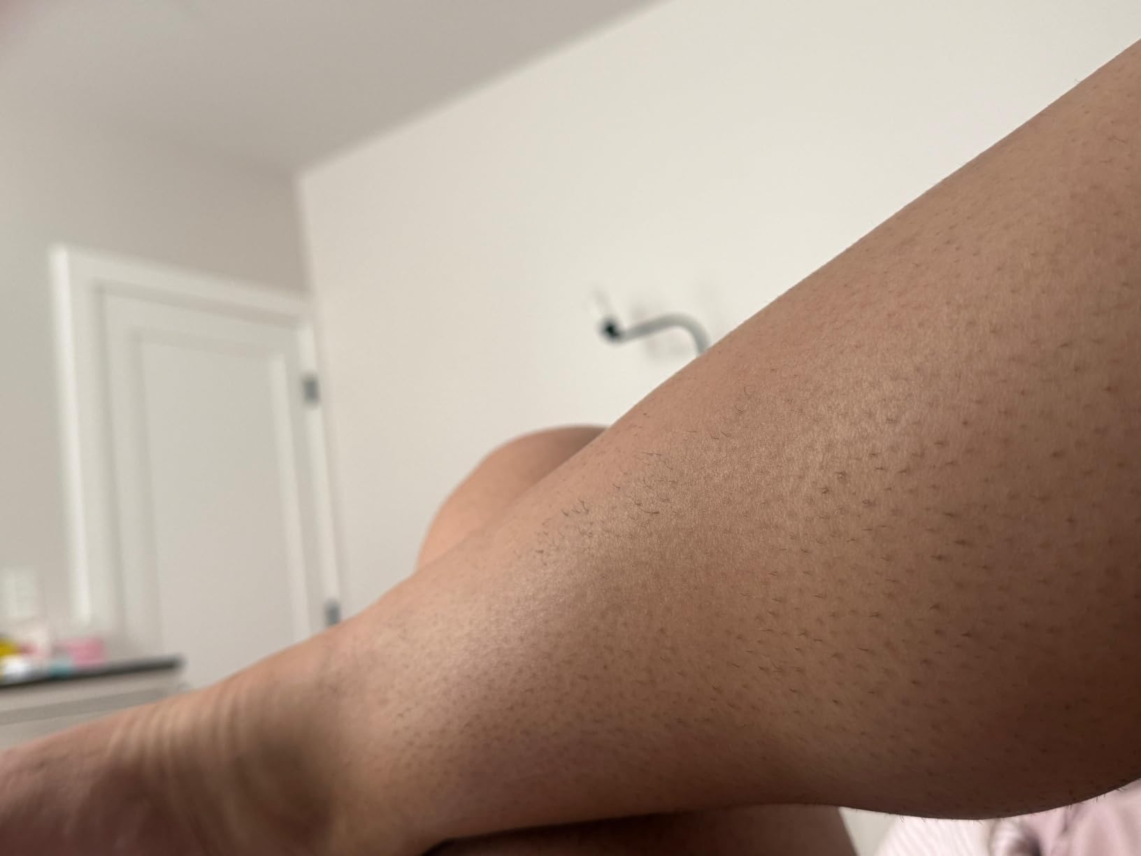 Philips Lumea IPL - Salon-Like Laser Hair Removal for Women, Permanent Hair Reduction Device At Home for Face & Body - Safe & Painless for Face, Bikini, Body, 5 Settings & Skin Sensors, BRI937/03 customer photo 1