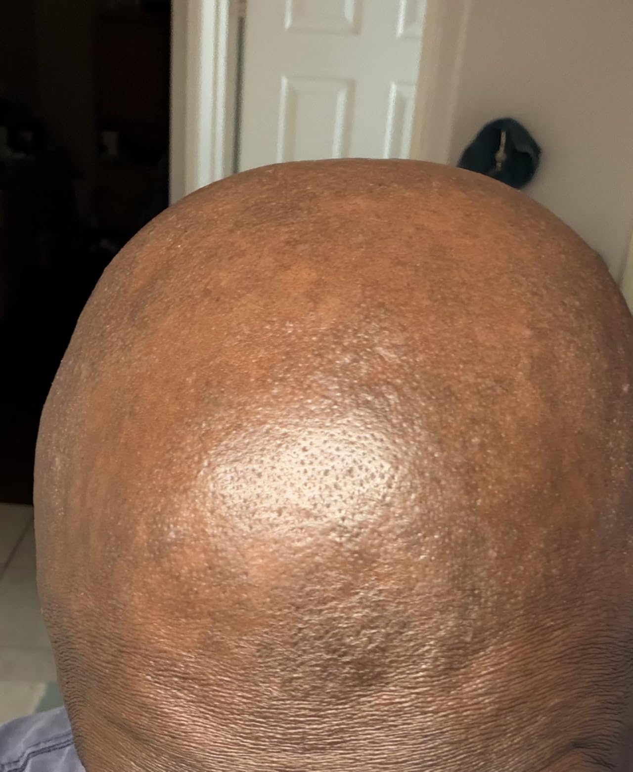 Philips Norelco Head Shaver Pro 9000 Series - Electric Shaver for Men and Women, 360-Degree Flexing Head & ComfortCut Blades for Clean Shave, Gentle on Skin, Model HS9980/40 customer photo 1